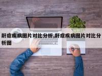 鼾症疾病图片对比分析,鼾症疾病图片对比分析图