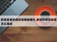 鼾症患者的症状有哪些图片,鼾症的症状表现怎么描述