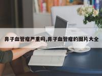 鼻子血管瘤严重吗,鼻子血管瘤的图片大全