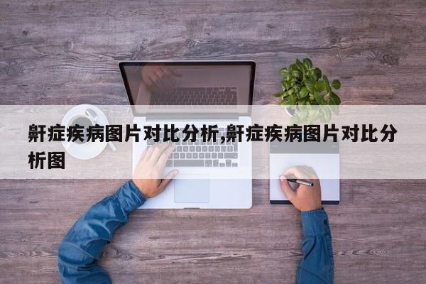 鼾症疾病图片对比分析,鼾症疾病图片对比分析图